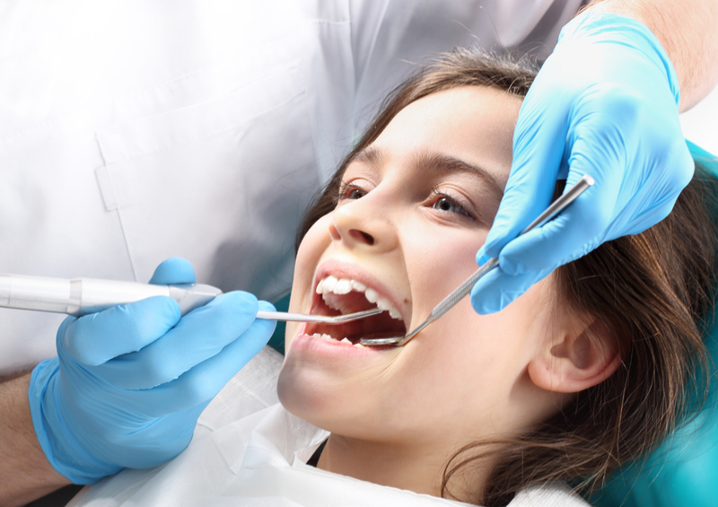 Dental Sealants -  image